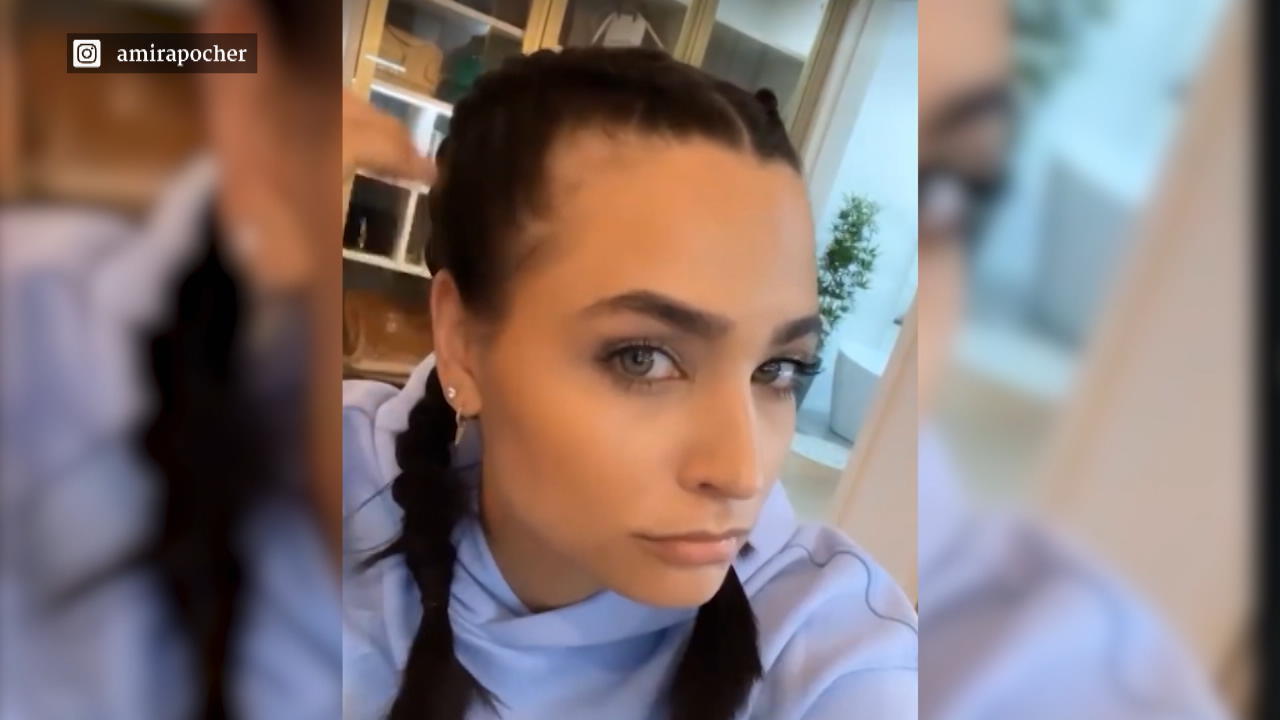 Amira Pocher zeigt Schwangerschafts-Folgen