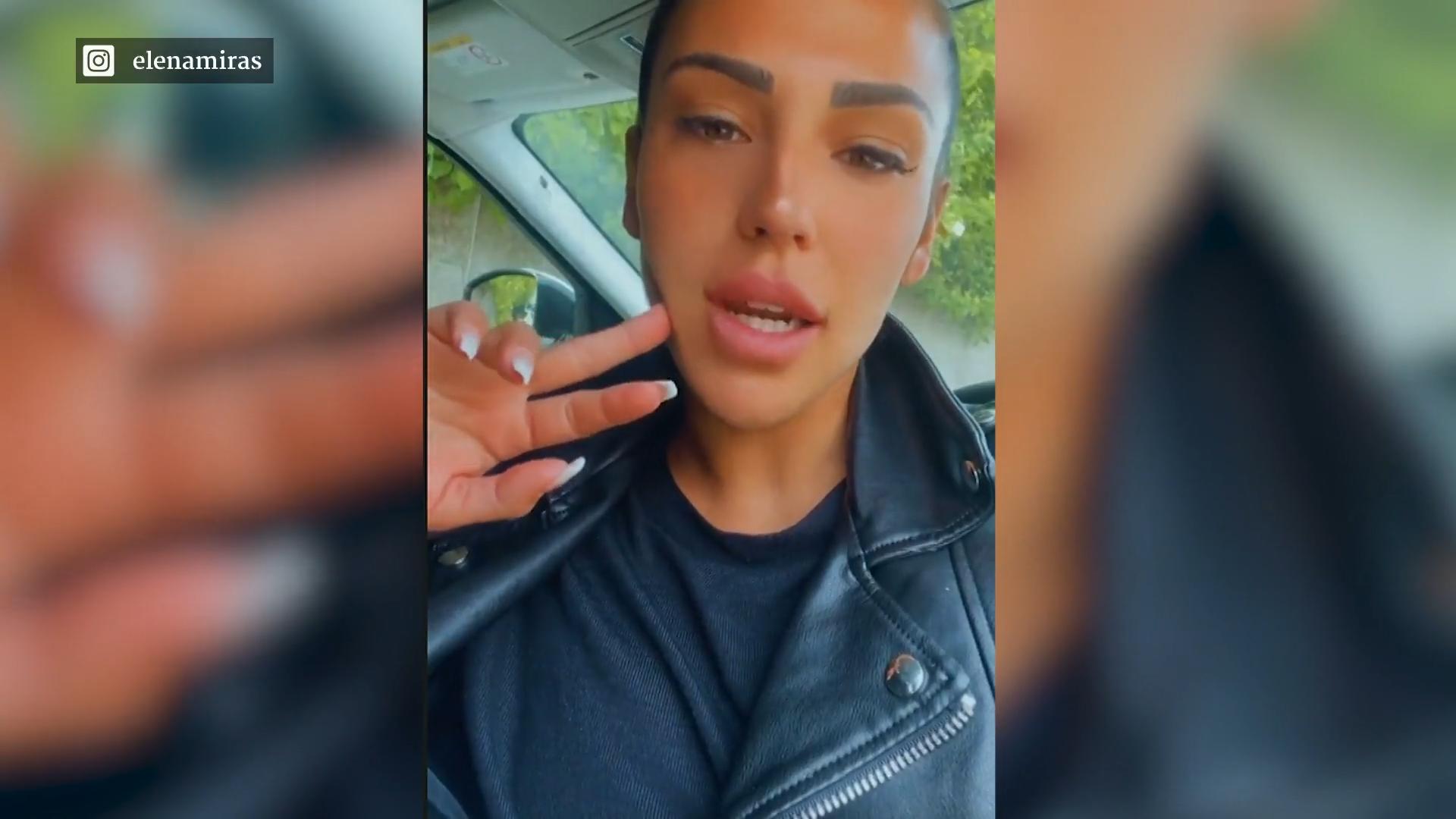 Nach Brust-OP: Elena Miras' Narbe hat sich entzündet
