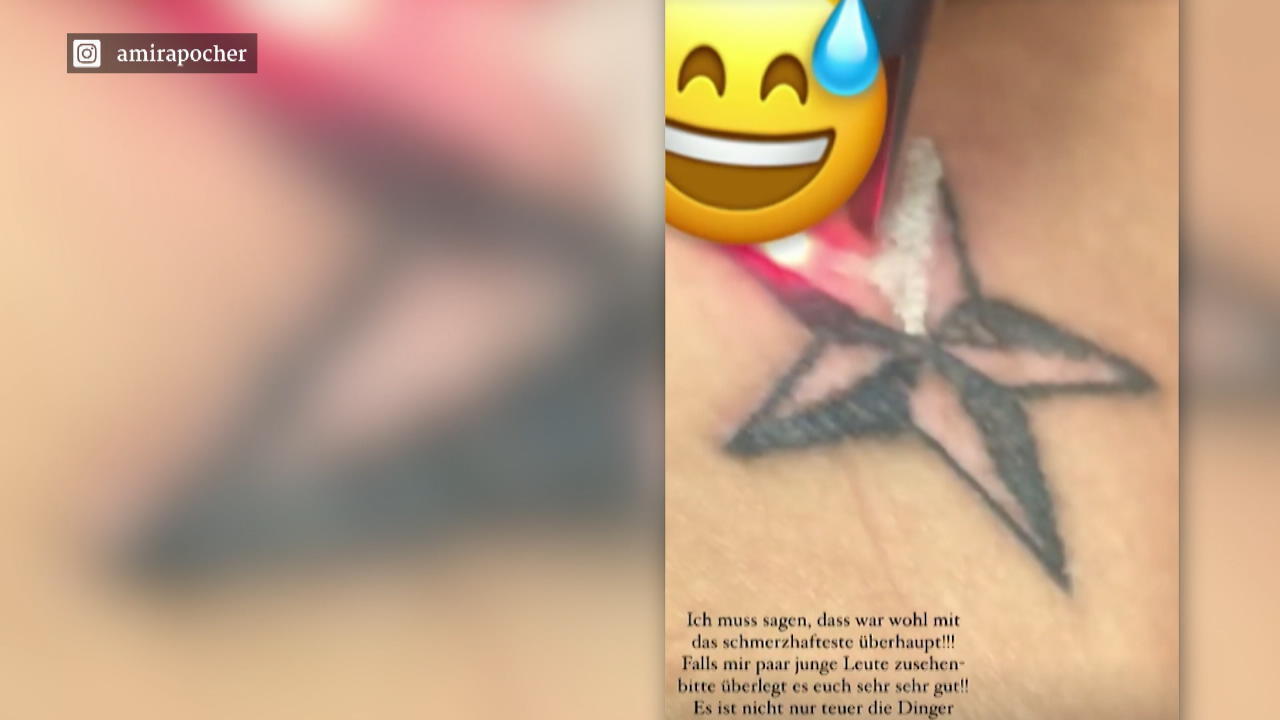 Amira Pocher lässt ihre Tattoos entfernen
