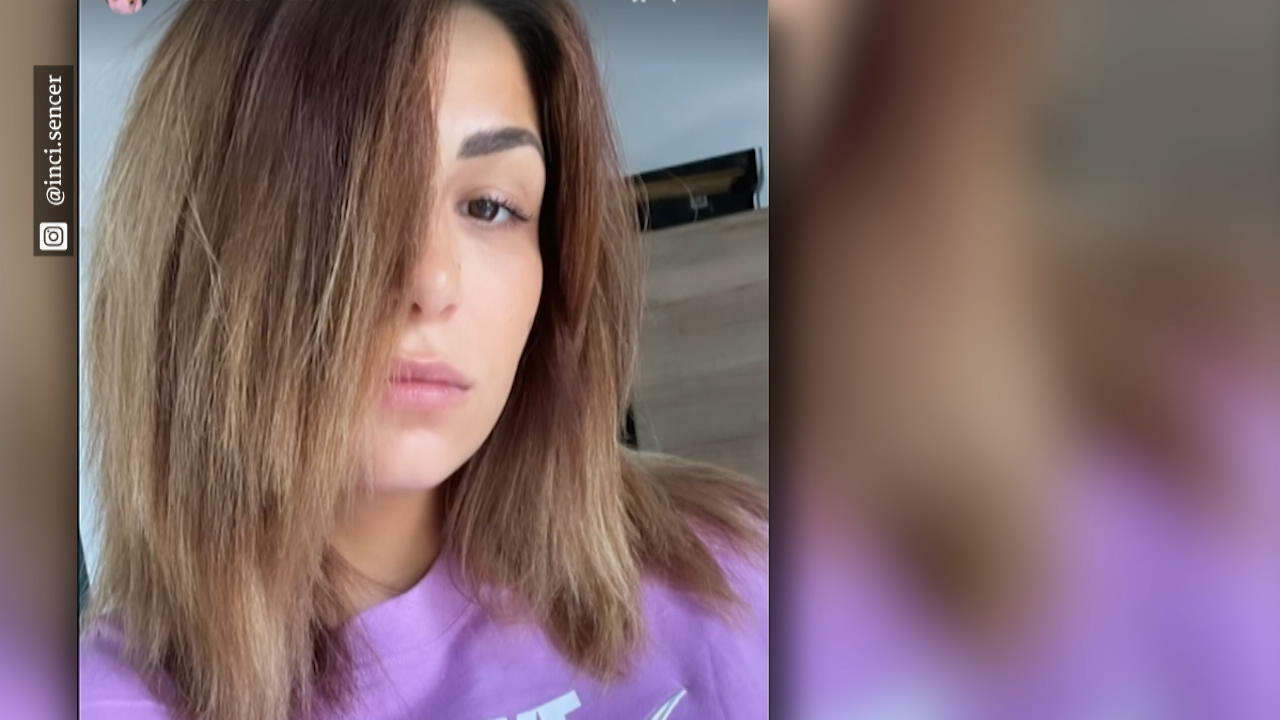 Inci Sencer fallen büschelweise Haare aus