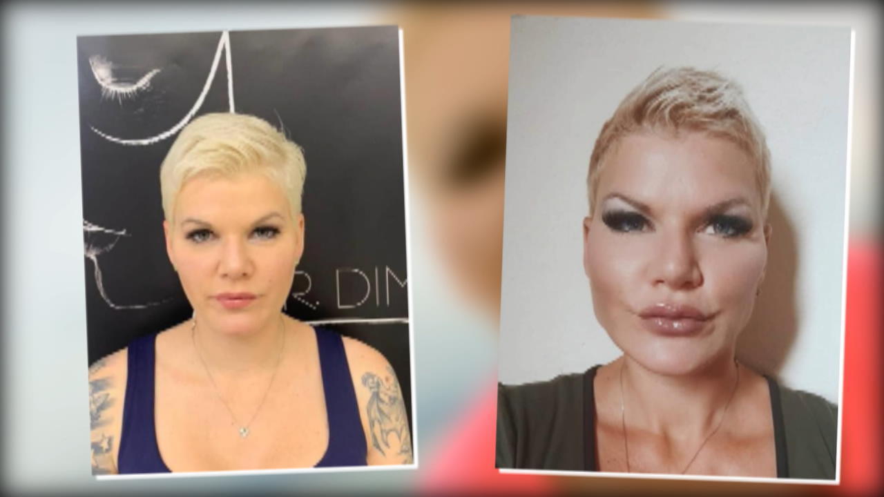 Fans erkennen ihr Gesicht nach Schönheits-OP nicht wieder