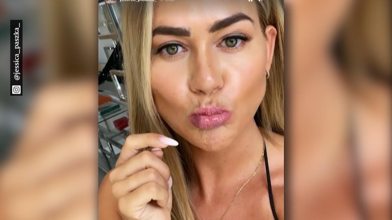 Deshalb hat Jessica Paszka blaue Lippen