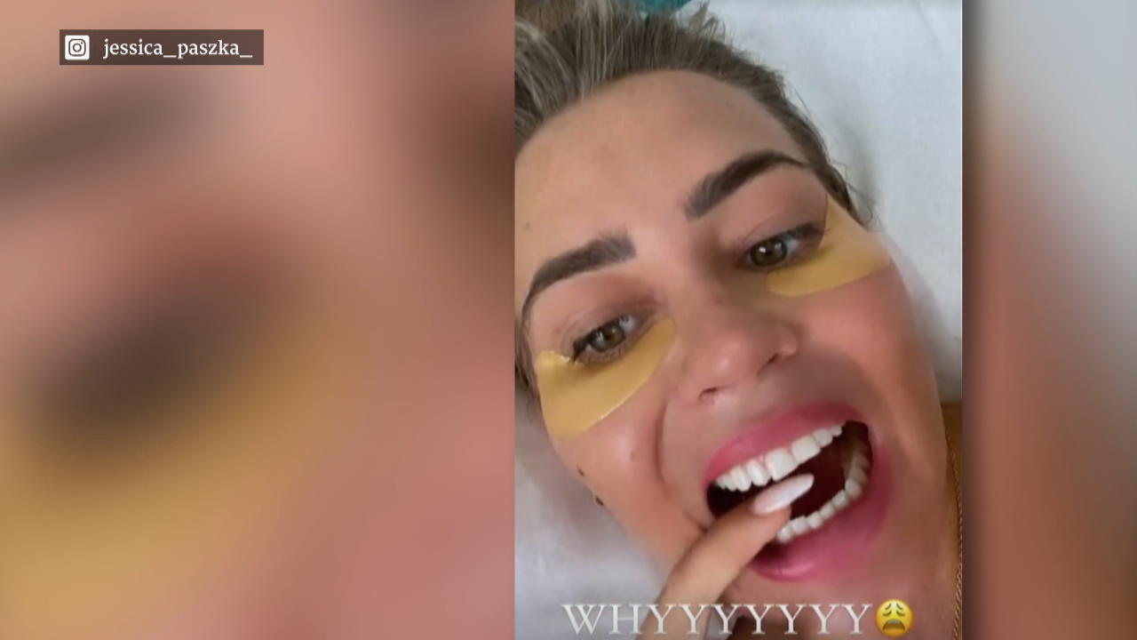 Jessica Paszka verliert Zahn