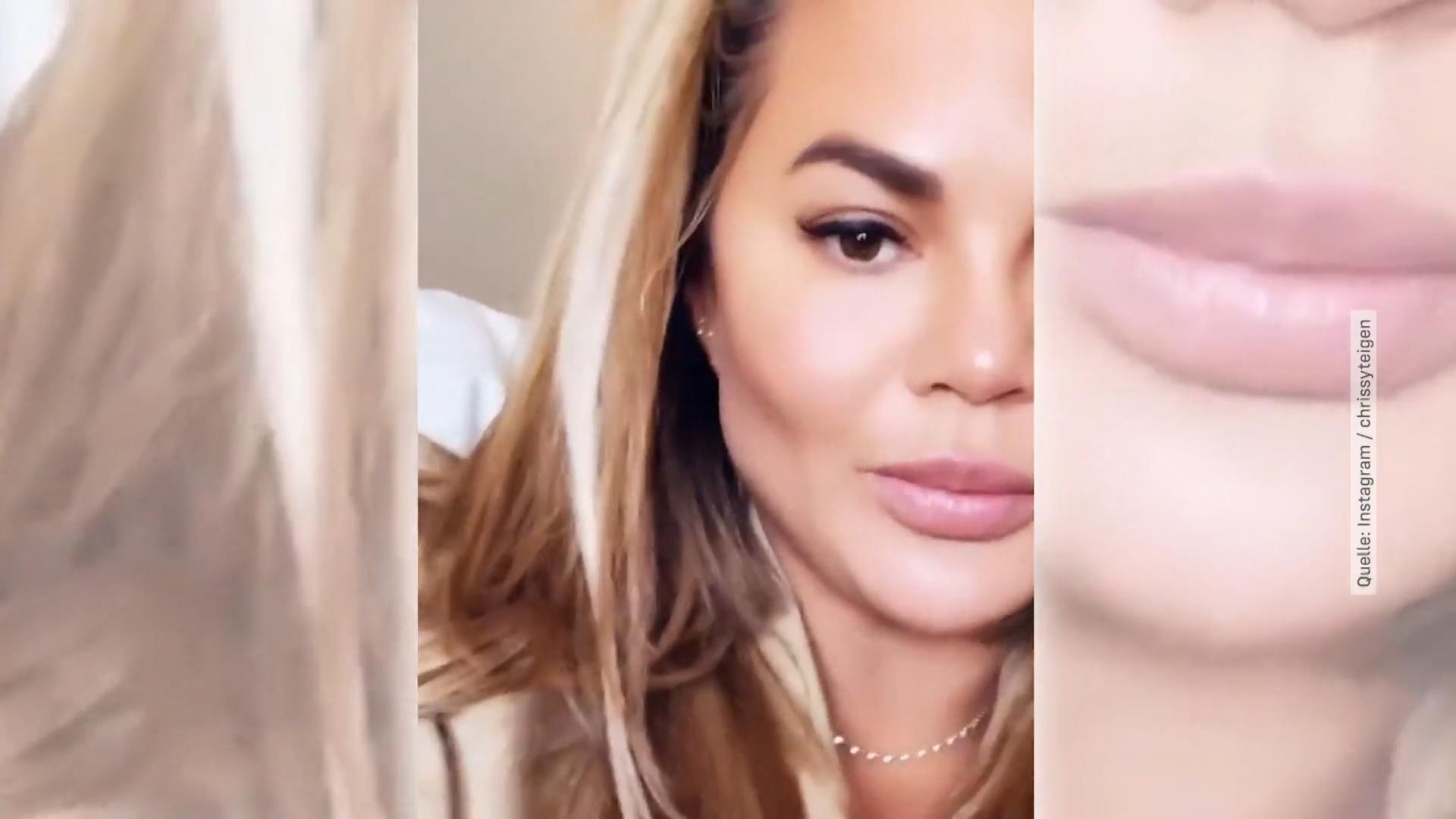 Chrissy Teigen beim Beauty-Doc
