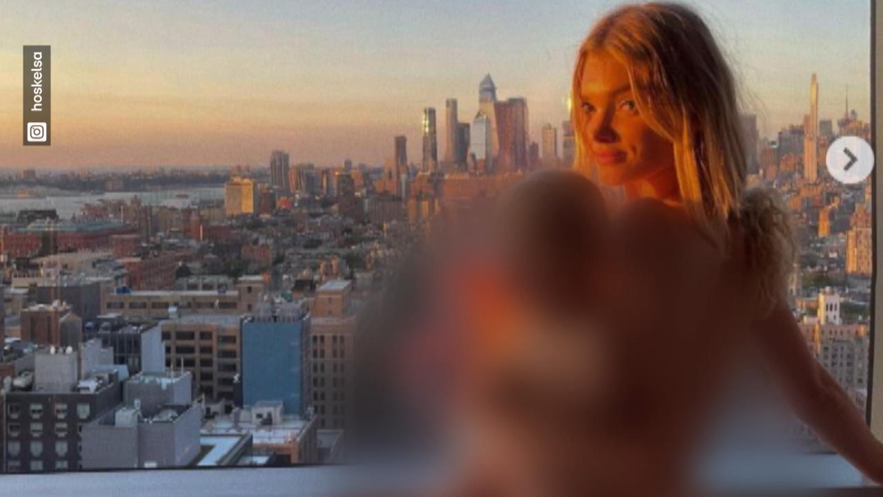 Model Elsa Hosk rechtfertigt sich