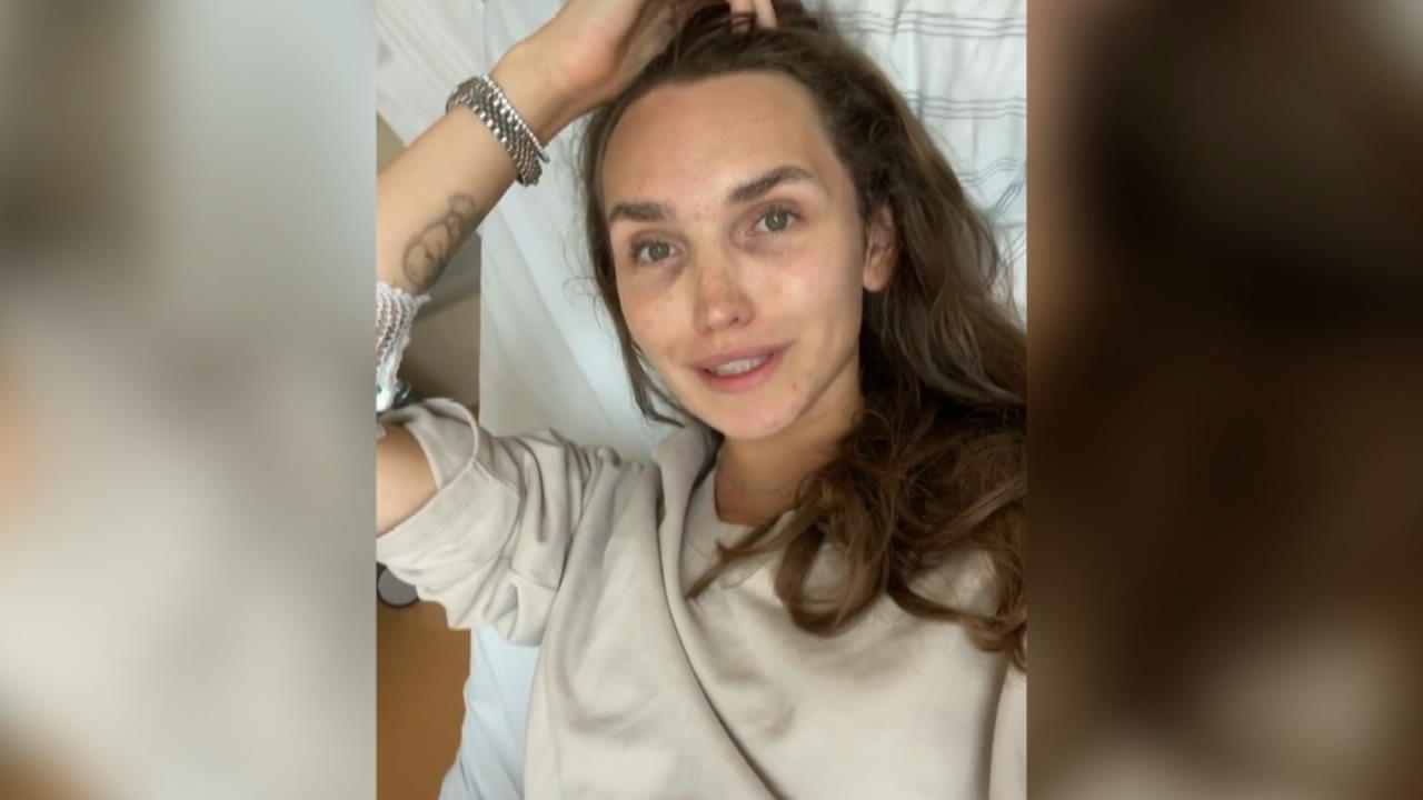 Anna Wilken nach Eizellen-Punktion in Klinik