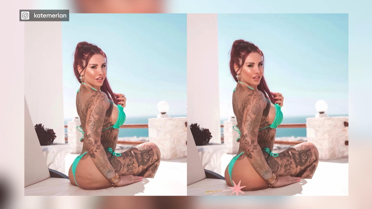 Kate Merlan: Cellulite-Bild begeistert Fans