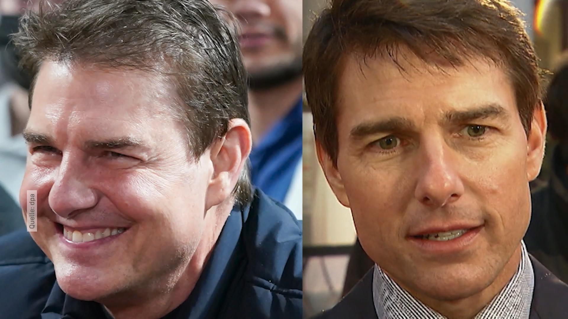 War bei Tom Cruise der Schönheits-Doc dran?