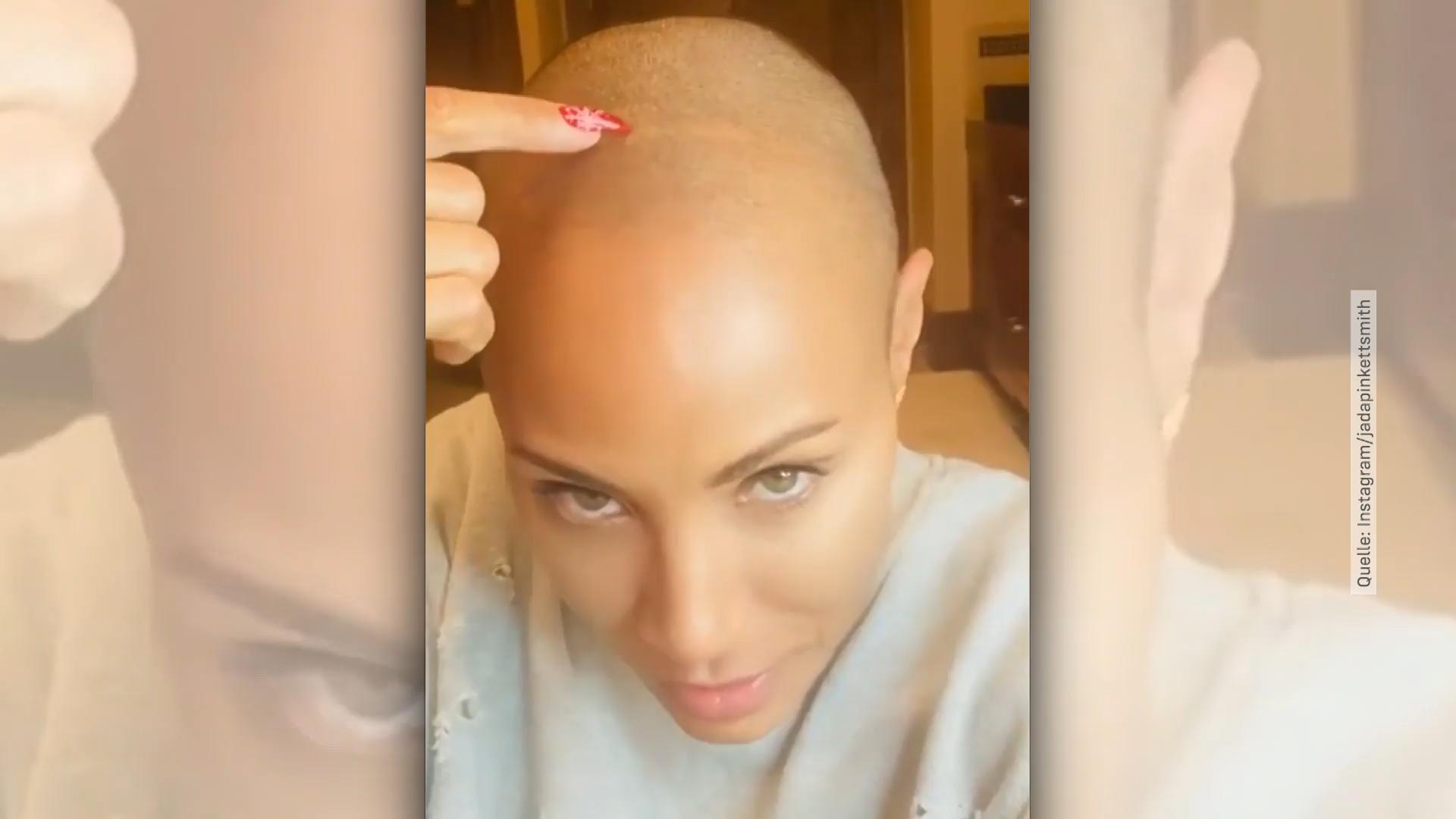 Jada Pinkett Smith lebt selbstbewusst mit Haarausfall