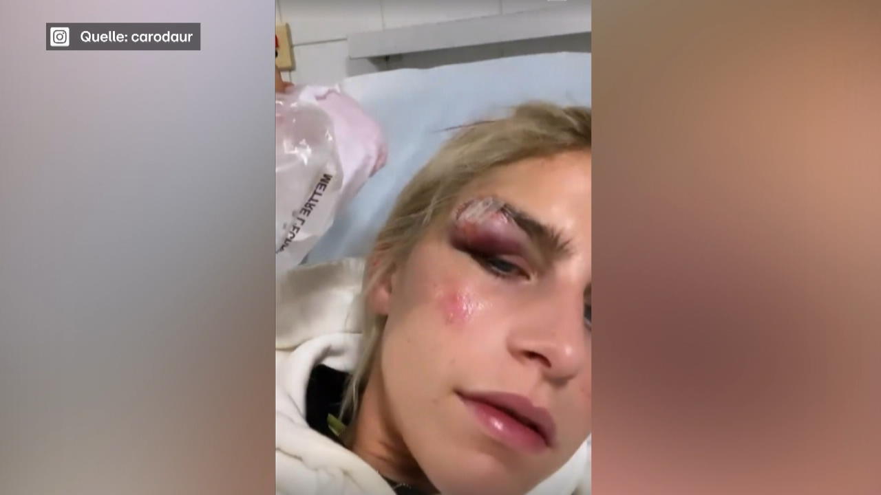 Caro Daur hatte blutigen Jogging-Unfall