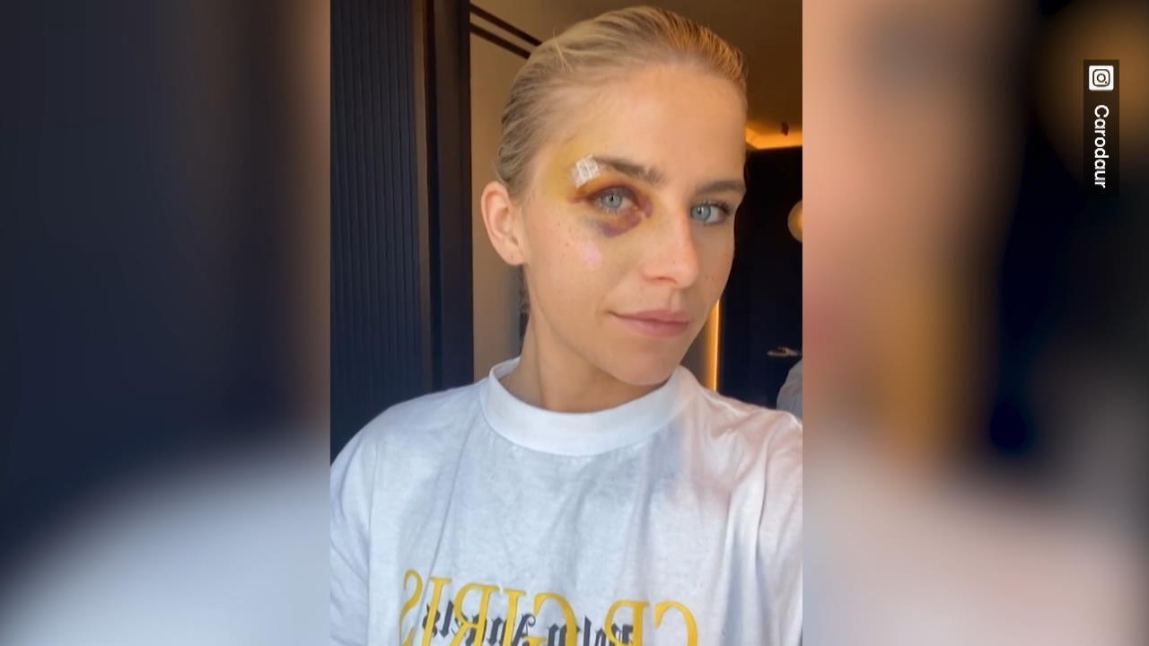 Caro Daur gibt Gesundheitsupdate