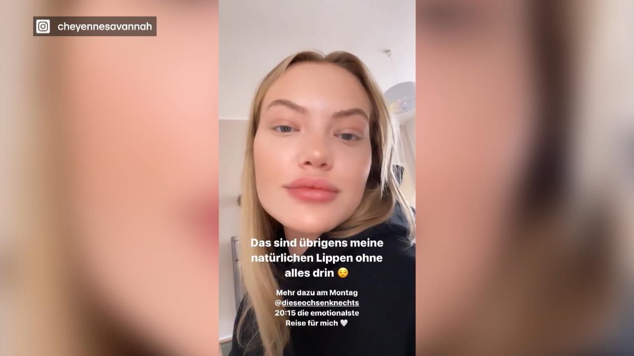 So sehen Cheyenne Ochsenknechts Lippen ohne Filler aus!