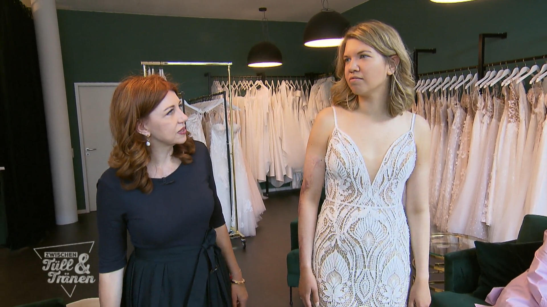 Kathi muss ihre Narben nicht verstecken