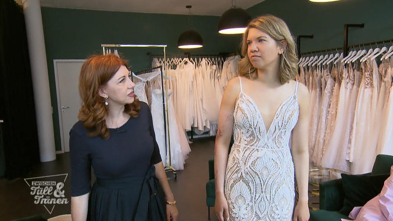 Kathi muss ihre Narben nicht verstecken