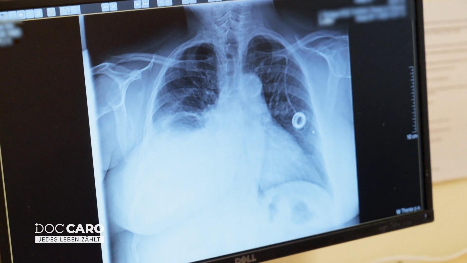 Doc Caro überprüft die Röntgenbilder