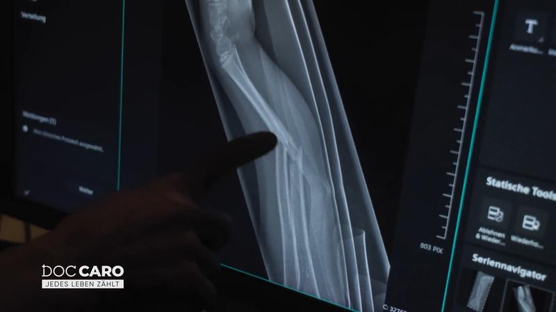 Die junge Patientin muss operiert werden