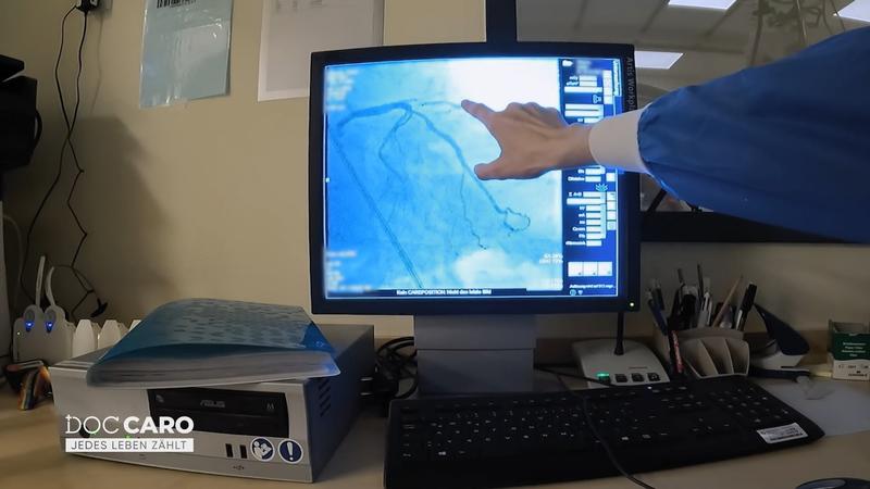 Eine Herzkranzarterie ist komplett verschlossen